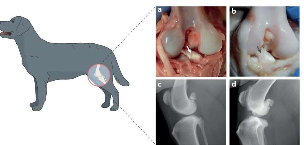 Ligament rupture caused by osteoarthritis